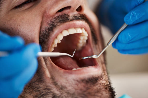 Best Mobile Emergency Dentist in Upper Brookville, NY