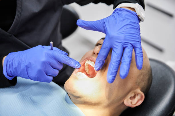 Best Emergency Dentist for Knocked-Out Tooth in Upper Brookville, NY